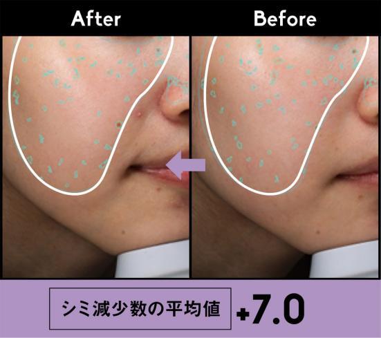 ETVOS 甘草次酸硬脂酯 美白淡斑精華液 在日本被譽為功能最全的精華