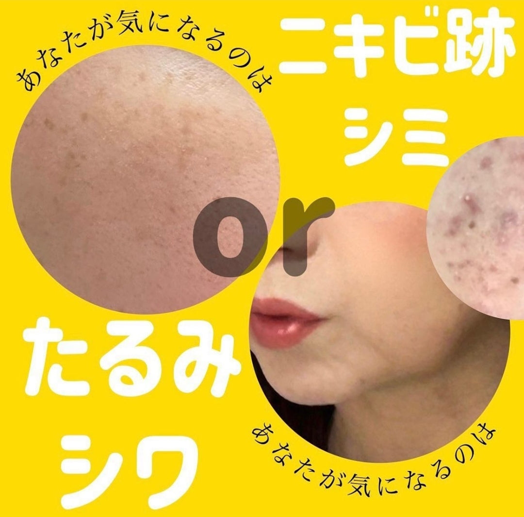 水僑保壽堂 30秒黑頭噴霧 Emulsion Remover